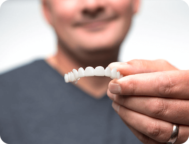 Man holding Instasmile veneers