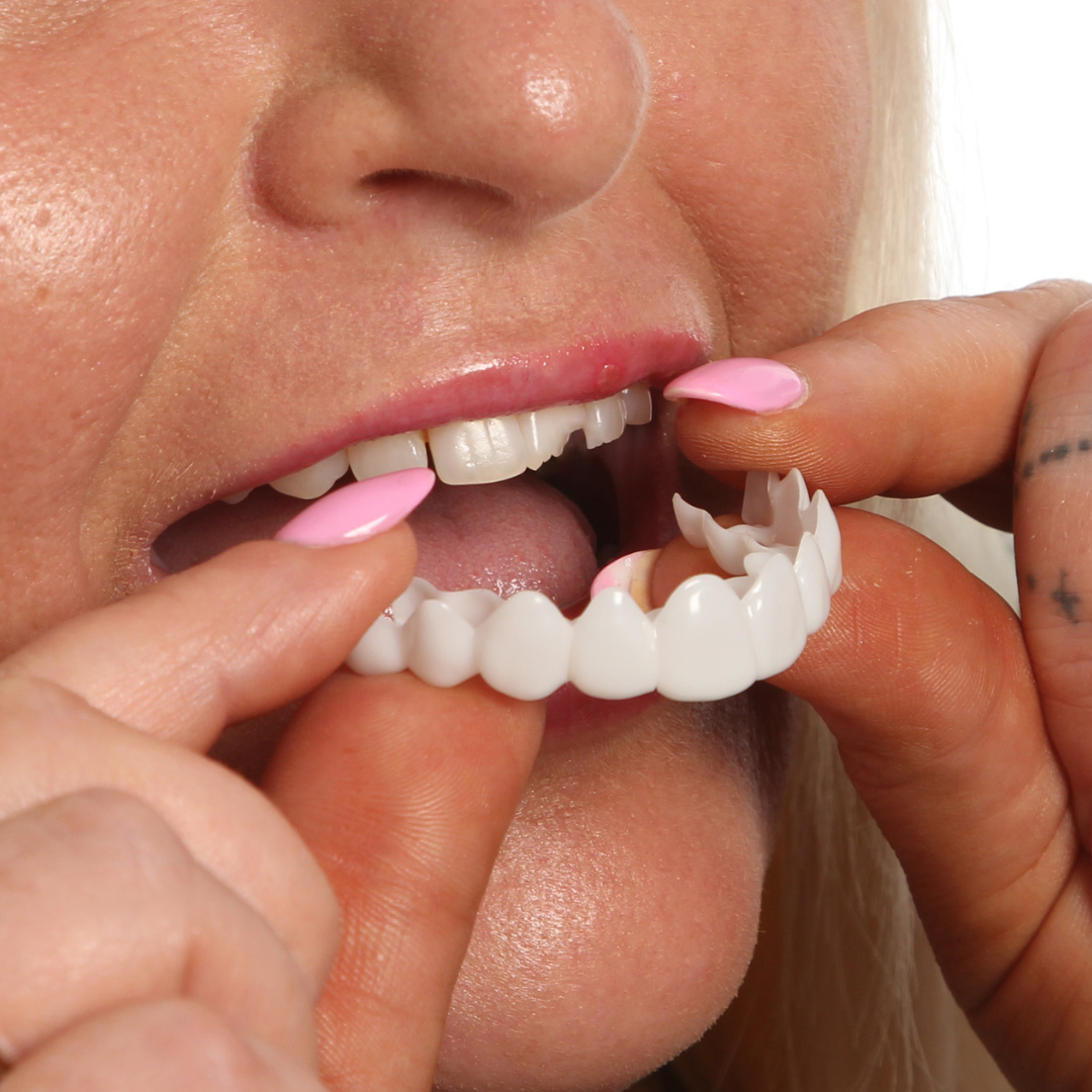 Result example for chipped teeth