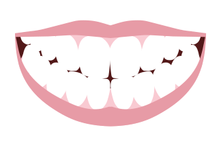 Both teeth