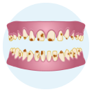 Amelogenesis Imperfecta icon