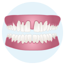 Gaps Between Teeth icon