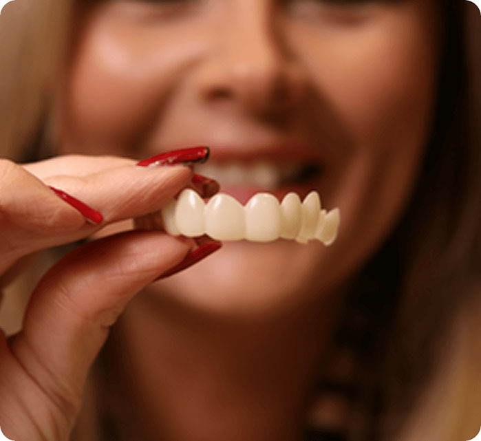 Woman holding Instasmile veneers in front of face.