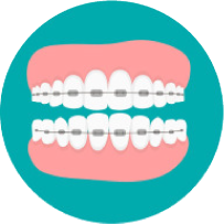 Loose teeth