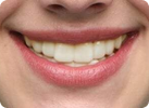 A3 shade example