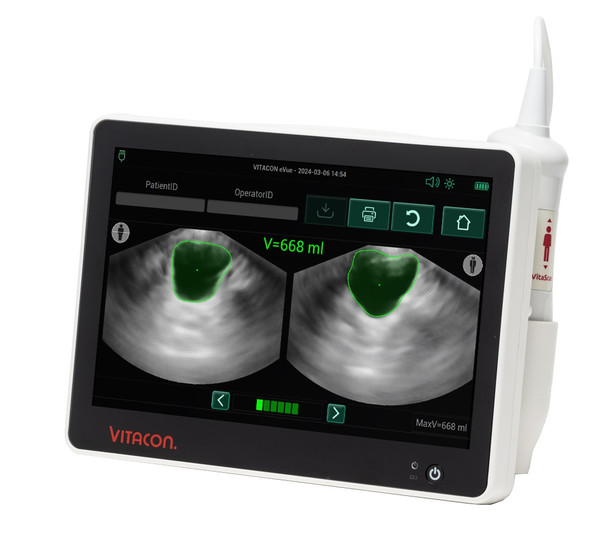 Vitacon Vitascan eVue Bladder Scanner Call for Best Pricing