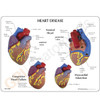  Hemoton 3pcs Cardiac Support Chest pacemaker Cushion