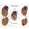 3 Mini Heart Set - Card front