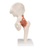 Functional Hip Joint