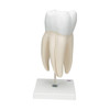 Giant Molar with Dental Cavities Human Tooth Model, 15 times Life-Size, 6 part