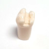 Preprepared Tooth - 3.6 (#19) MOD Prep - LL66C