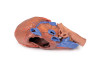 Heart and the distal trachea, carina and primary bronchi - 3D Printed Cadaver