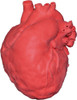 Pediatric heart with atrial septal defect (ASD)