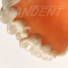 Preprepared Tooth - 1.5 Crown - UR50