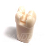 Preprepared Tooth - 1.6 (#3) MOD Prep - UR66A