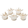 Set of 5 Lumbar Vertebrae