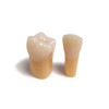 Composite Resin Tooth with Orange Caries for NDEB