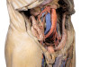 Abdomen with bilateral Hernias