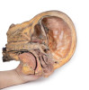 Sagittal Section of Head and Neck with Infratemporal Fossa and Carotid Sheath Dissection