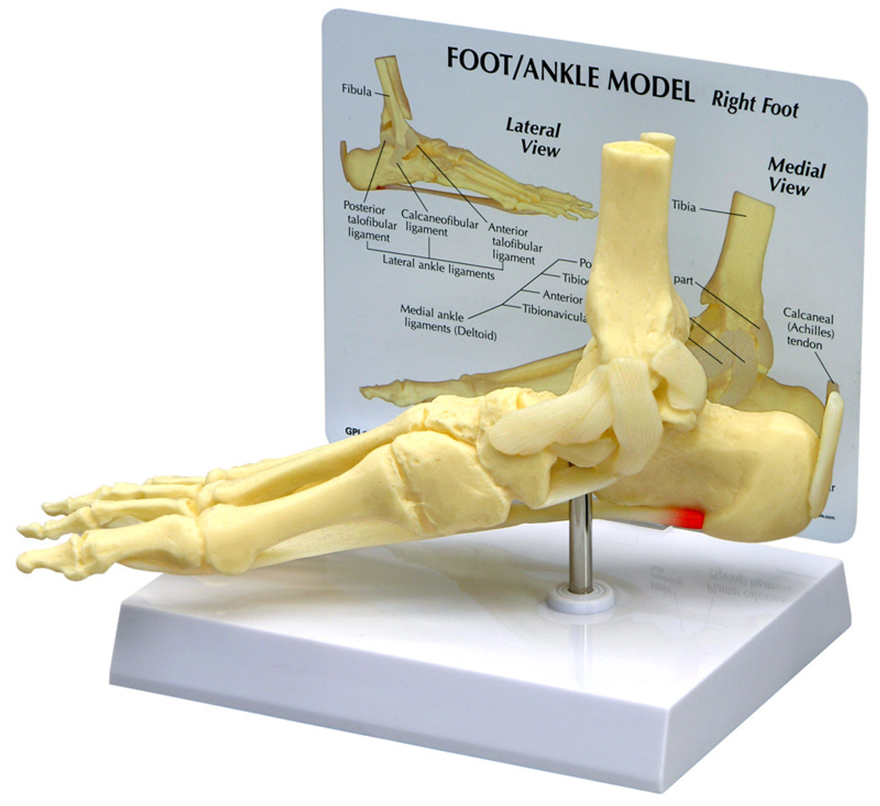 Anatomy Stock Images  ankle-ligaments-medial-deltoid-ligament -ligamentum-deltoideum-tibiotalaris-anterior-posterior-tibiocalcanea-tibionavicularis