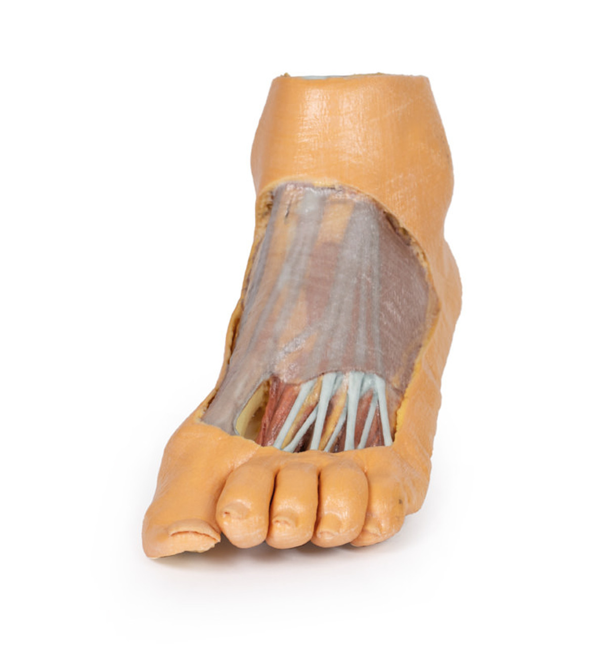 Anatomy of the plantar aspect of the foot demonstrating the bands of