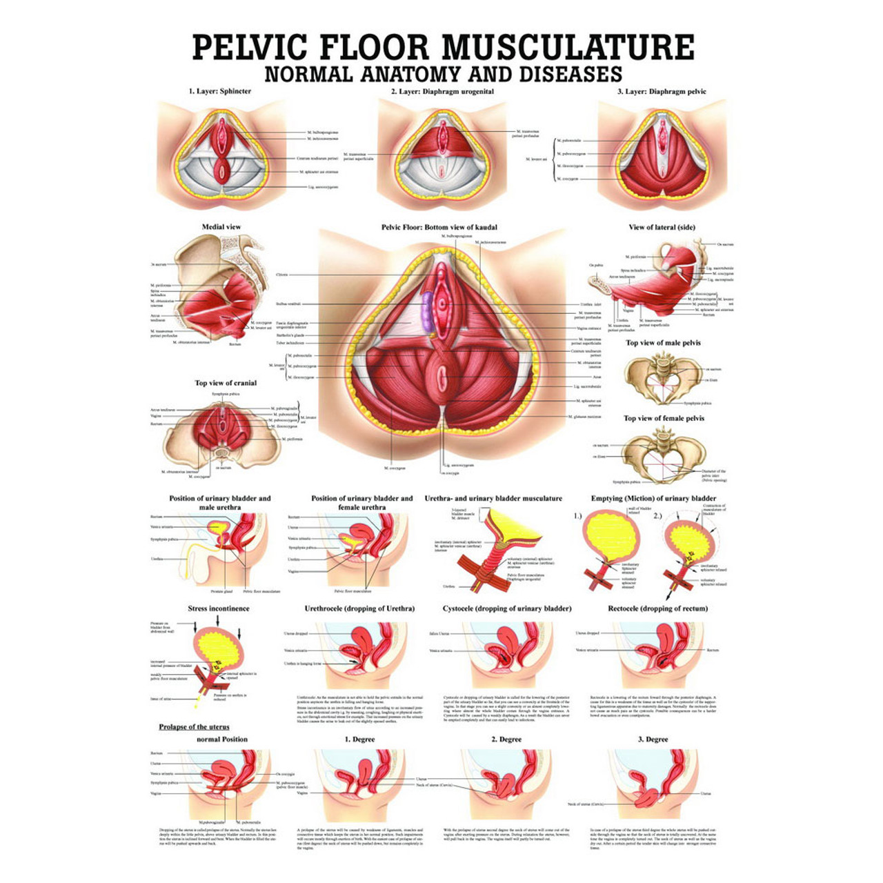 Pelvic Floor Musculature Poster - Normal Anatomy and Diseases