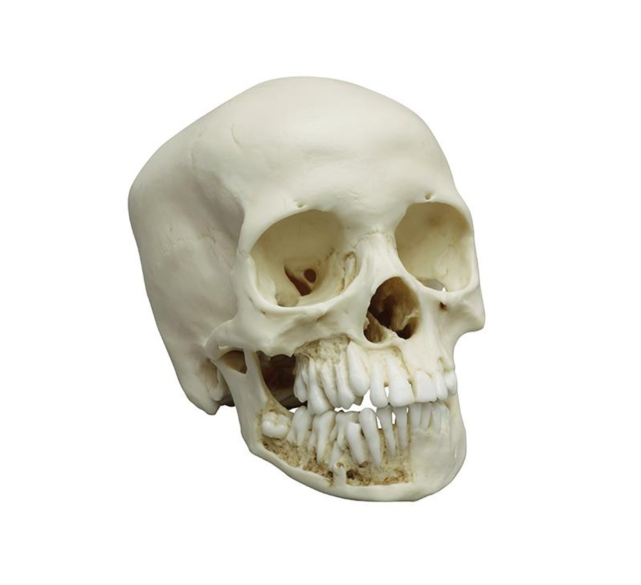 Child skull, 12 year old