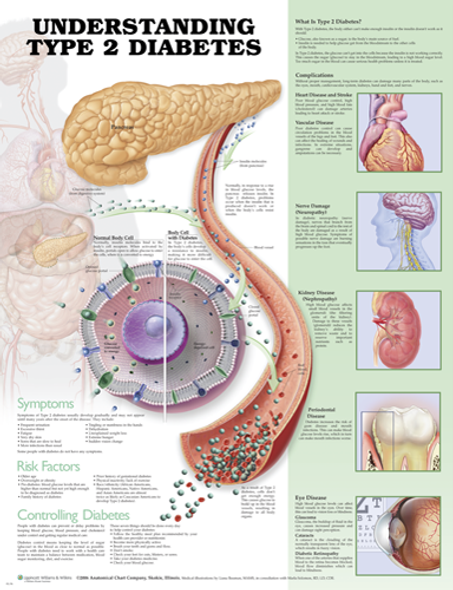 Understanding Type 2 Diabetes