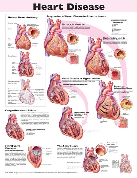 Heart Disease