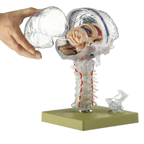 Transparent Brain Model Somso Bs 25/T - open