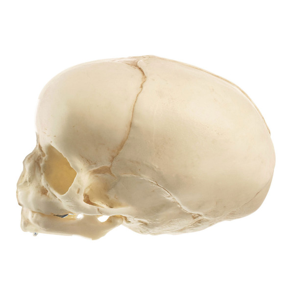 Artificial Skull of a Fetus Somso Qs 3/3