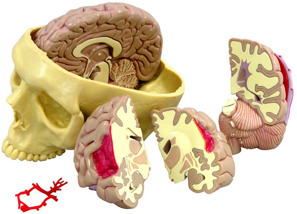 Brain in Base of Skull