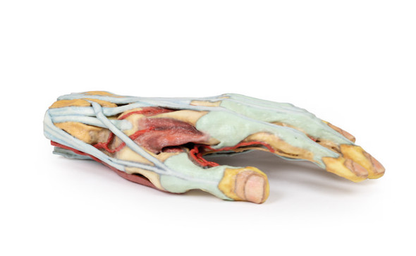 Hand Anatomy - 3D Printed Cadaver