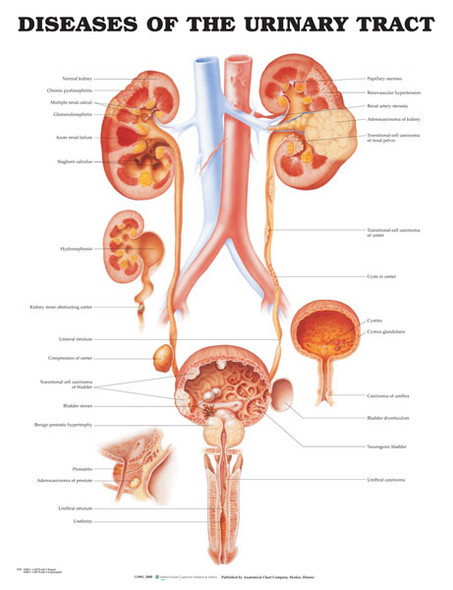 Diseases of the Urinary Tract