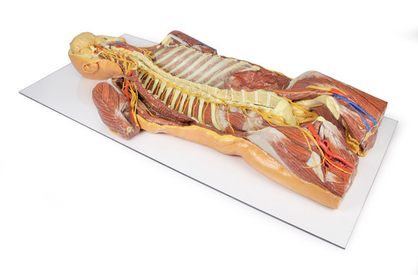 Posterior Body Wall / Ventral Deep Dissection - 3D Printed Cadaver