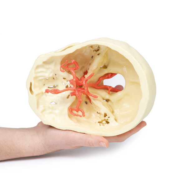 Circle of Willis - 3D Printed Cadaver