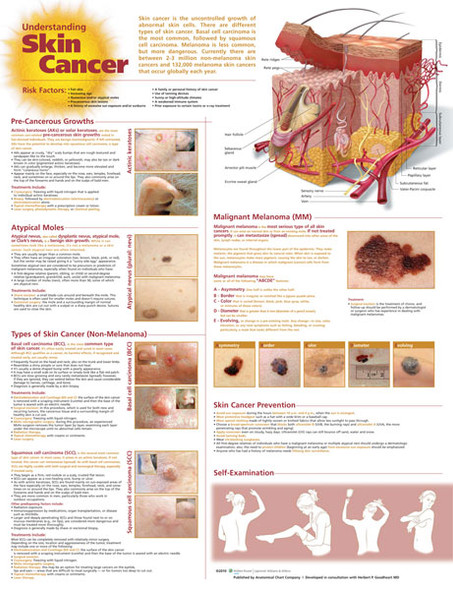 Understanding Skin Cancer