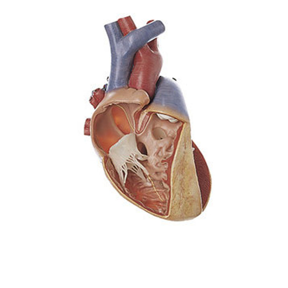 Various Defects of the Ventricular Septum Somso Os 7/3