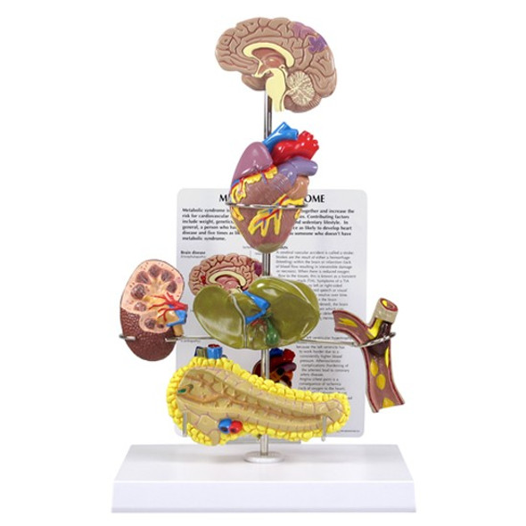 Metabolic Syndrome