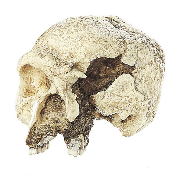 Skull of the Steinheim Prehistoric Man, Homo steinheimensis | Somso S 11