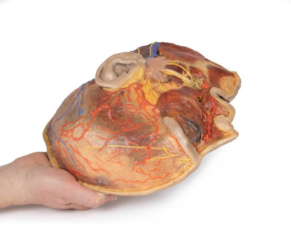 Superficial Facial nerves & Parotid Gland