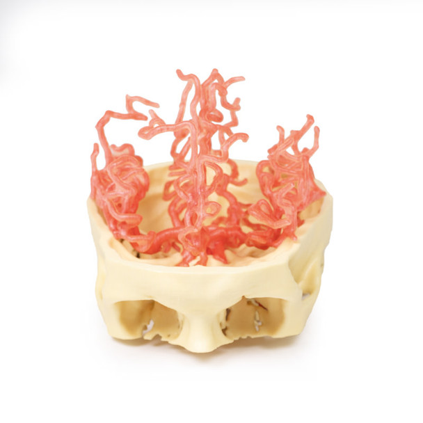Arterial Circulation | 3D Printed Cadaver