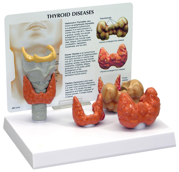 Thyroid model - GPI 3150