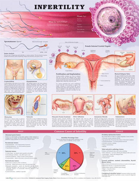 Infertility