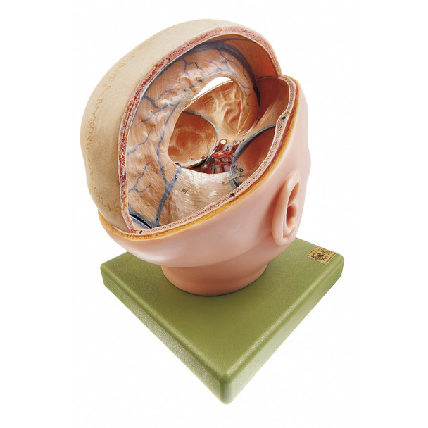 Proportions of the Dura Mater Somso Bs 2