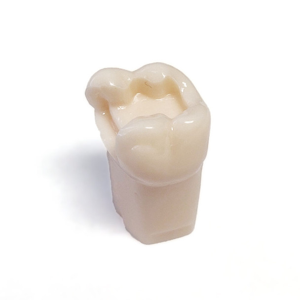 Preprepared Tooth - 2.6 (#14) Large MO Prep - UL64C