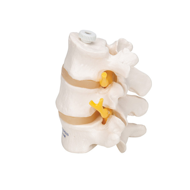 3 Lumbar Vertebrae