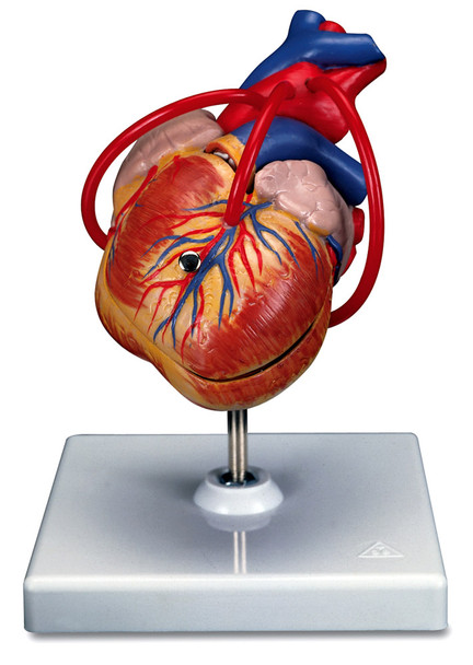 Heart Model with Bypass