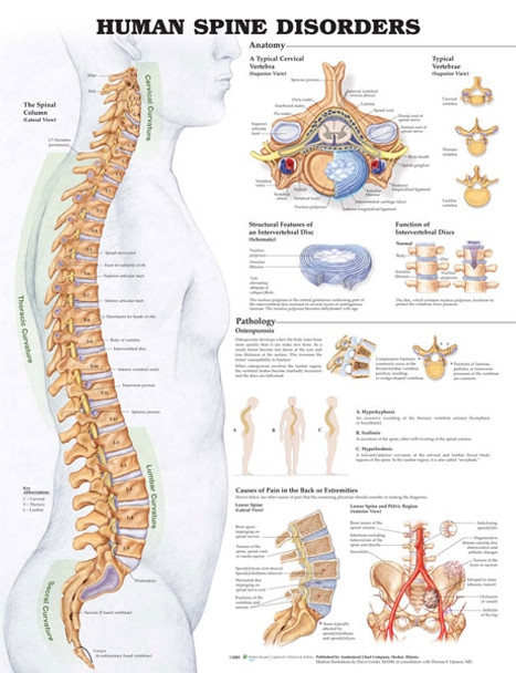 Human Spine Disorders - anatomical wall chart