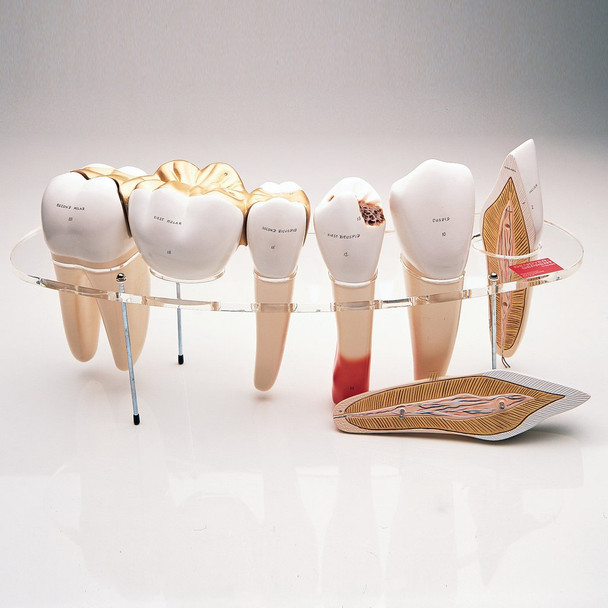 Dental Morphology 7-Part Series - Denoyer Geppert