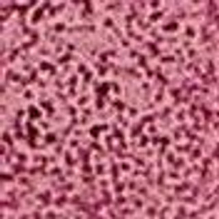 Thumbnail 8: Mauve Multi